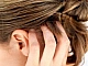 10 meilleurs shampooings pour le psoriasis sur la tête
